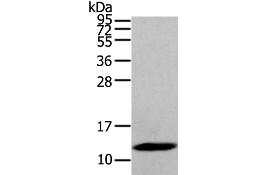 DEFB112 Antibody from Signalway Antibody (40368) - Antibodies.com