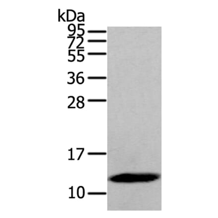 DEFB112 Antibody from Signalway Antibody (40368) - Antibodies.com