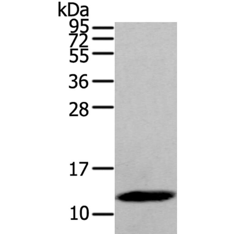 DEFB112 Antibody from Signalway Antibody (40368) - Antibodies.com