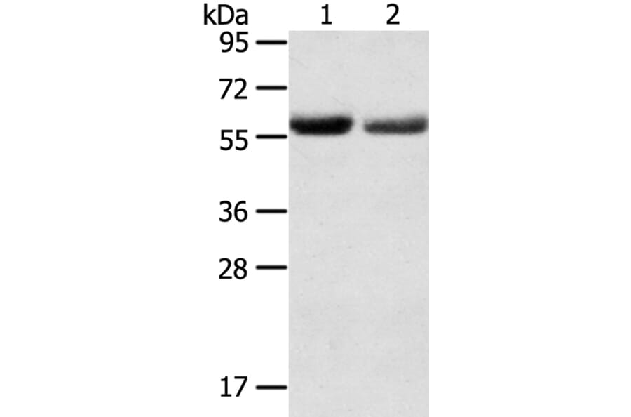 SLC16A9 Antibody from Signalway Antibody (40369) - Antibodies.com