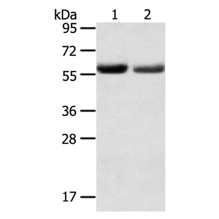 SLC16A9 Antibody from Signalway Antibody (40369) - Antibodies.com