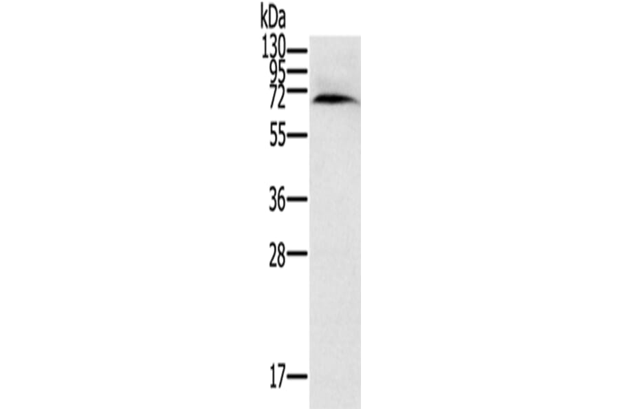 CYP11A1 Antibody from Signalway Antibody (42715) - Antibodies.com