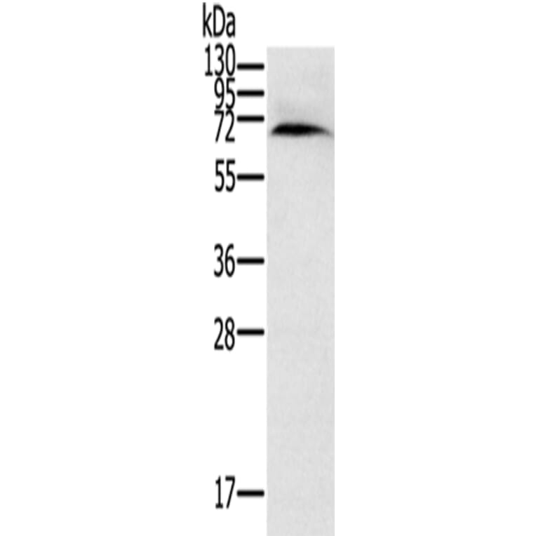 CYP11A1 Antibody from Signalway Antibody (42715) - Antibodies.com