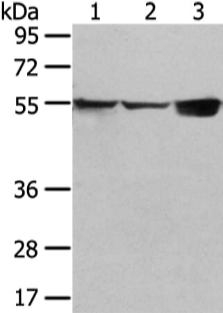 Gel: 6%SDS-PAGE Lysate: 40 &#956;g Lane 1-3: 231 and hela cell, mouse liver tissue Primary antibody: 1/300 dilution Secondary antibody: Goat anti rabbit IgG at 1/8000 dilution Exposure time: 10 seconds