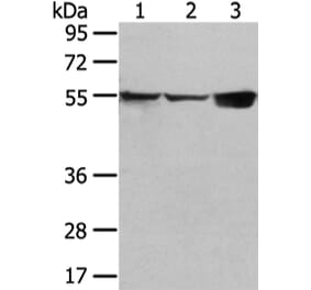 UGT1A10 Antibody from Signalway Antibody (42804) - Antibodies.com