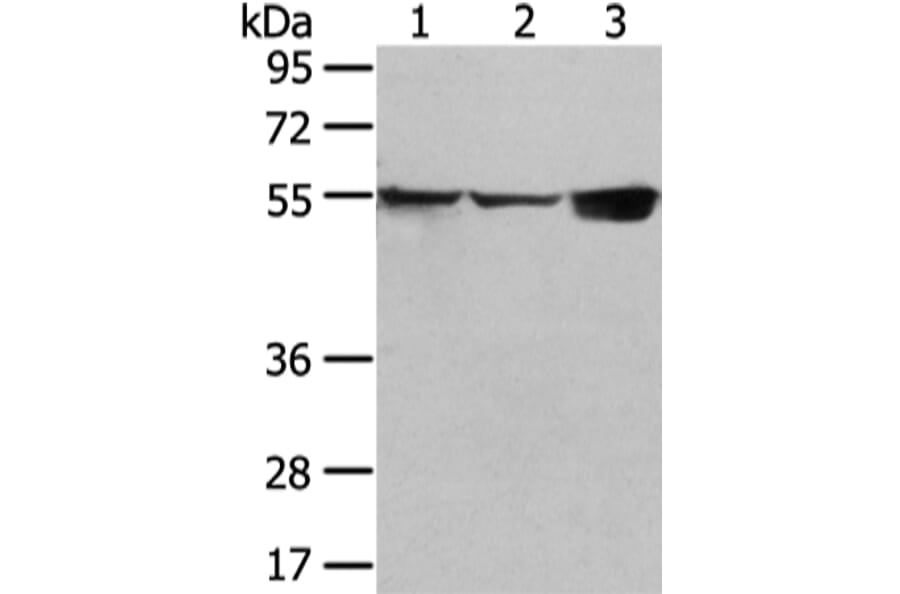 UGT1A10 Antibody from Signalway Antibody (42804) - Antibodies.com