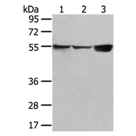 UGT1A10 Antibody from Signalway Antibody (42804) - Antibodies.com