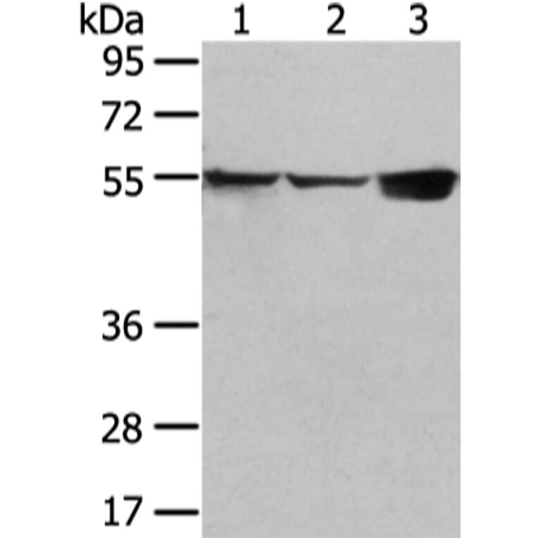 UGT1A10 Antibody from Signalway Antibody (42804) - Antibodies.com