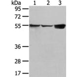 UGT1A10 Antibody from Signalway Antibody (42804) - Antibodies.com