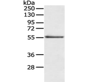 SLC29A1 Antibody from Signalway Antibody (43124) - Antibodies.com