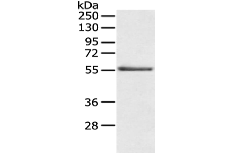 SLC29A1 Antibody from Signalway Antibody (43124) - Antibodies.com