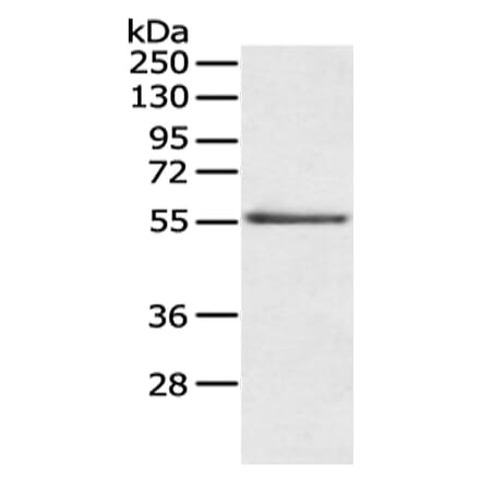 SLC29A1 Antibody from Signalway Antibody (43124) - Antibodies.com