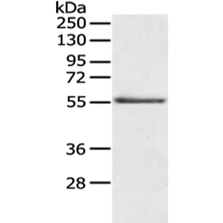 SLC29A1 Antibody from Signalway Antibody (43124) - Antibodies.com