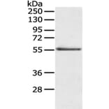 SLC29A1 Antibody from Signalway Antibody (43124) - Antibodies.com