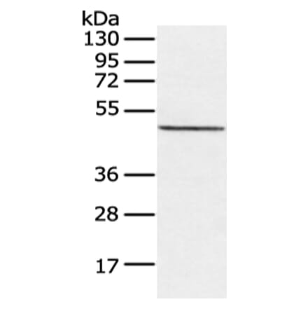 CXorf36 Antibody from Signalway Antibody (43128) - Antibodies.com