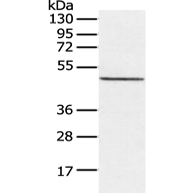 CXorf36 Antibody from Signalway Antibody (43128) - Antibodies.com