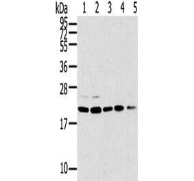 TPD52L1 Antibody from Signalway Antibody (43167) - Antibodies.com