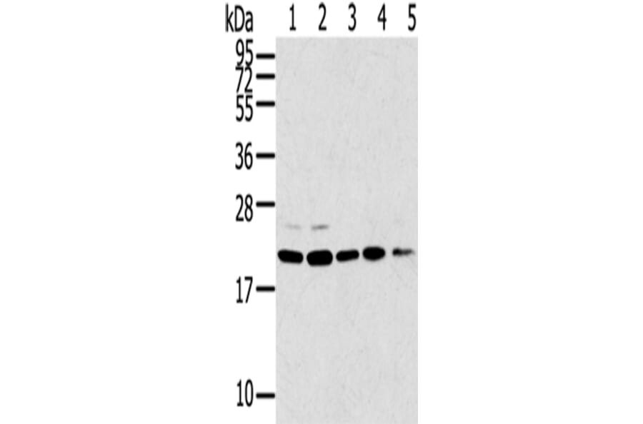 TPD52L1 Antibody from Signalway Antibody (43167) - Antibodies.com