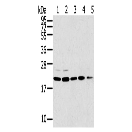 TPD52L1 Antibody from Signalway Antibody (43167) - Antibodies.com