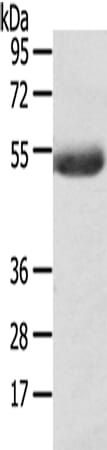 Gel: 8% SDS-PAGE Lysate: 40 &#956;g Lane: Mouse plasma tissue Primary antibody: 1/400 dilution Secondary antibody: Goat anti rabbit IgG at 1/8000 dilution Exposure time: 5 minutes