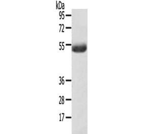 AGPAT6 Antibody from Signalway Antibody (43170) - Antibodies.com