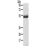 AGPAT6 Antibody from Signalway Antibody (43170) - Antibodies.com