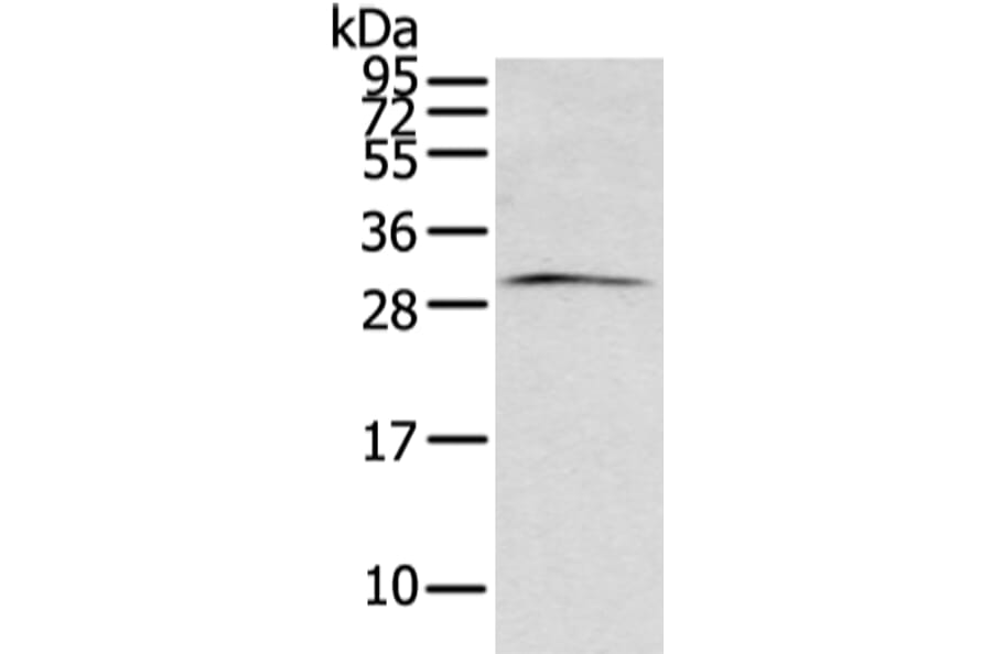 ZFAND2B Antibody from Signalway Antibody (43206) - Antibodies.com