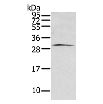 ZFAND2B Antibody from Signalway Antibody (43206) - Antibodies.com