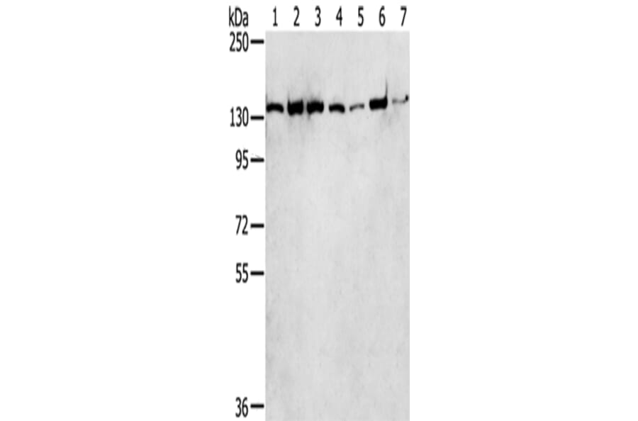 SMARCA5 Antibody from Signalway Antibody (43330) - Antibodies.com