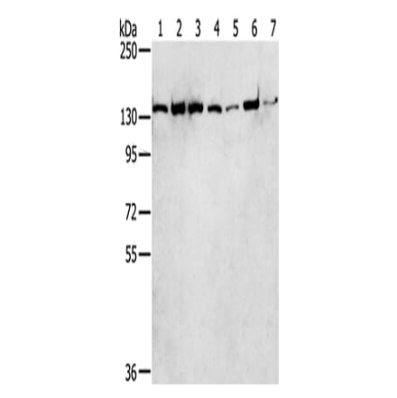 SMARCA5 Antibody from Signalway Antibody (43330) - Antibodies.com