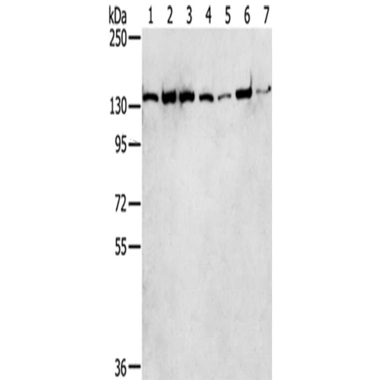 SMARCA5 Antibody from Signalway Antibody (43330) - Antibodies.com