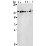 SMARCA5 Antibody from Signalway Antibody (43330) - Antibodies.com