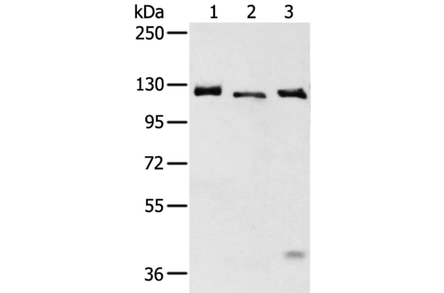 SLC4A3 Antibody from Signalway Antibody (43470) - Antibodies.com