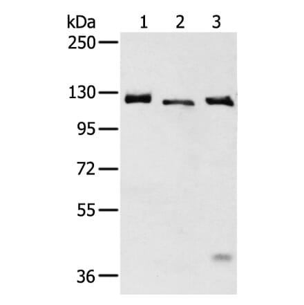 SLC4A3 Antibody from Signalway Antibody (43470) - Antibodies.com