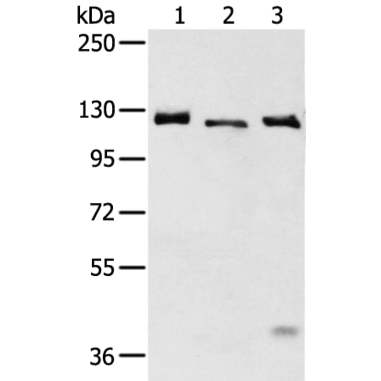 SLC4A3 Antibody from Signalway Antibody (43470) - Antibodies.com