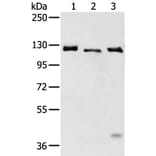 SLC4A3 Antibody from Signalway Antibody (43470) - Antibodies.com