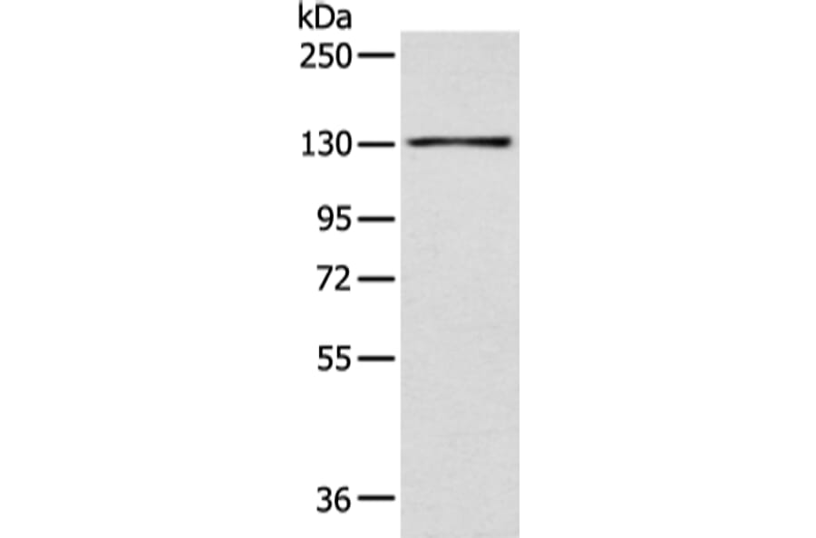 SMARCA1 Antibody from Signalway Antibody (43471) - Antibodies.com
