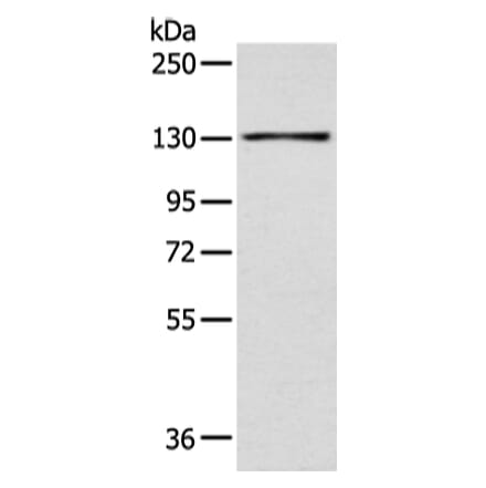 SMARCA1 Antibody from Signalway Antibody (43471) - Antibodies.com