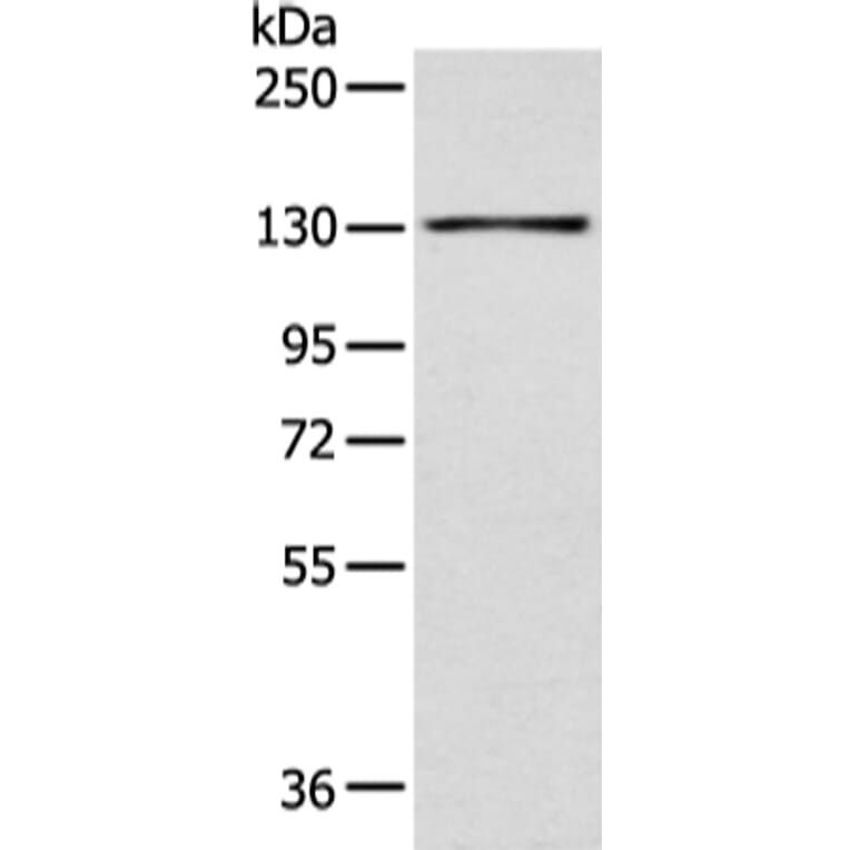 SMARCA1 Antibody from Signalway Antibody (43471) - Antibodies.com