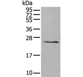 ABHD14B Antibody from Signalway Antibody (43552) - Antibodies.com