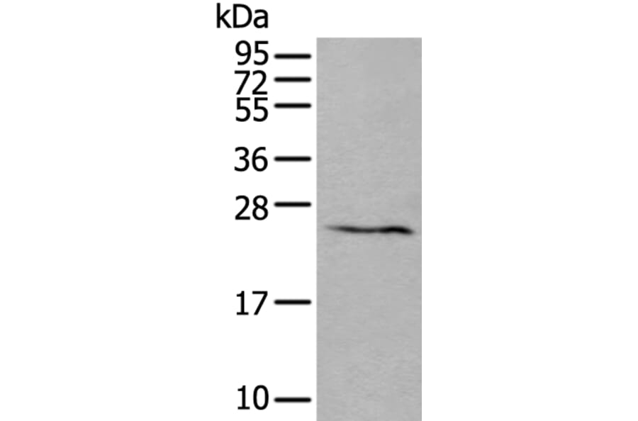 ABHD14B Antibody from Signalway Antibody (43552) - Antibodies.com