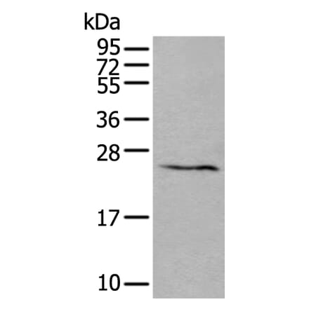 ABHD14B Antibody from Signalway Antibody (43552) - Antibodies.com