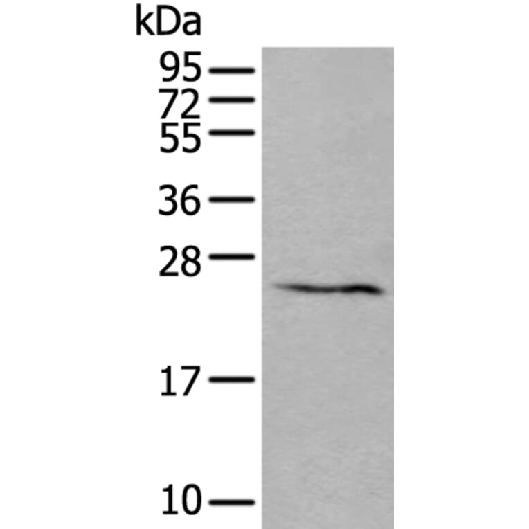 ABHD14B Antibody from Signalway Antibody (43552) - Antibodies.com