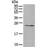 ABHD14B Antibody from Signalway Antibody (43552) - Antibodies.com