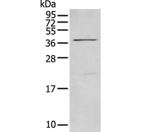 MAGEB18 Antibody from Signalway Antibody (43745) - Antibodies.com