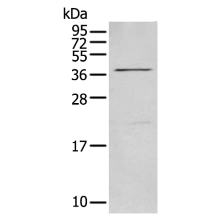 MAGEB18 Antibody from Signalway Antibody (43745) - Antibodies.com