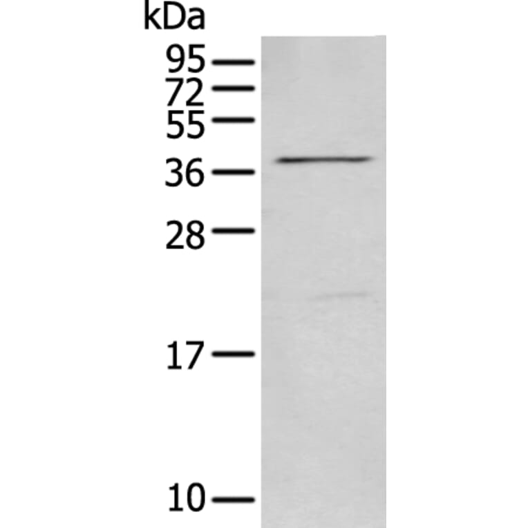 MAGEB18 Antibody from Signalway Antibody (43745) - Antibodies.com