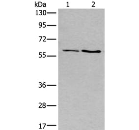 SLC17A8 Antibody from Signalway Antibody (43982) - Antibodies.com