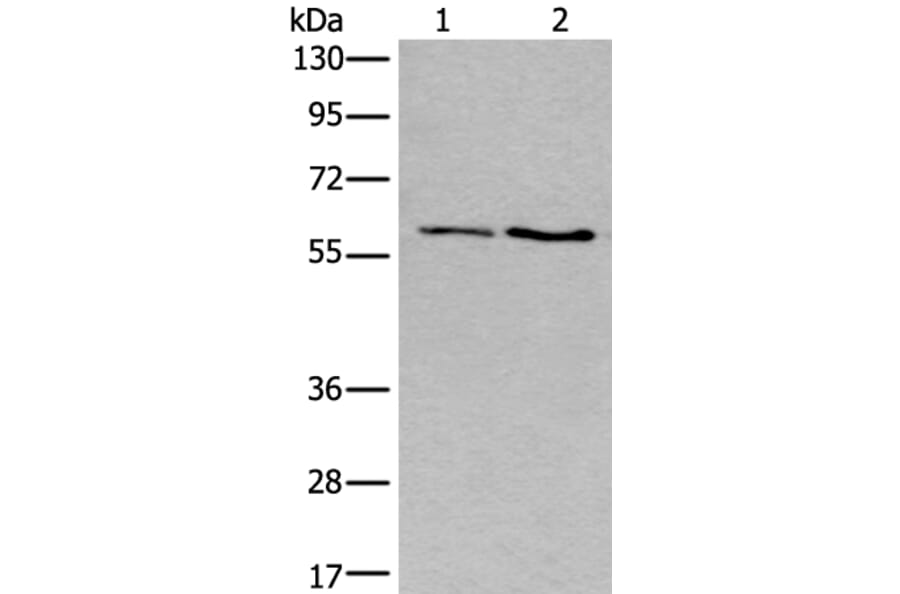 SLC17A8 Antibody from Signalway Antibody (43982) - Antibodies.com