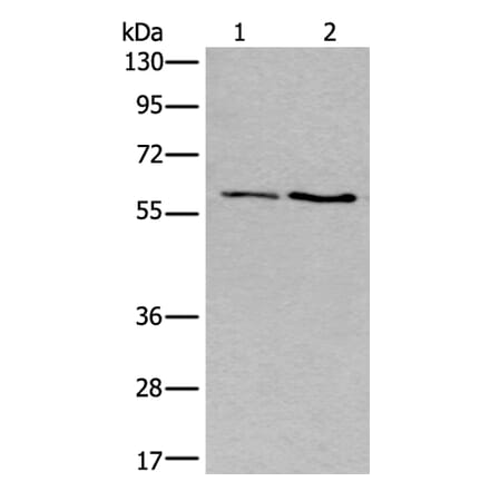 SLC17A8 Antibody from Signalway Antibody (43982) - Antibodies.com